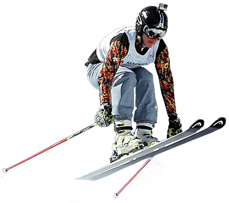 Skiers